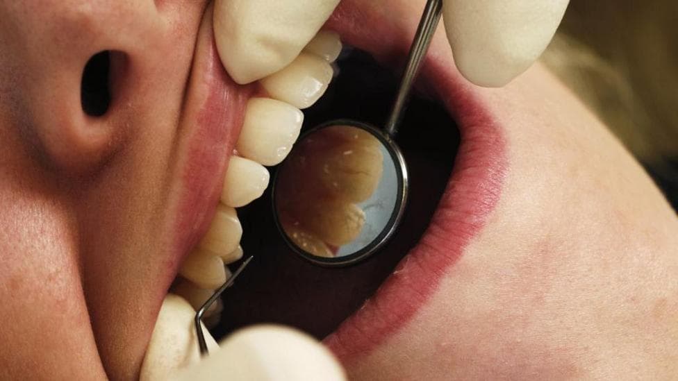 Sydney dentist's patients warned of viruses including HIV